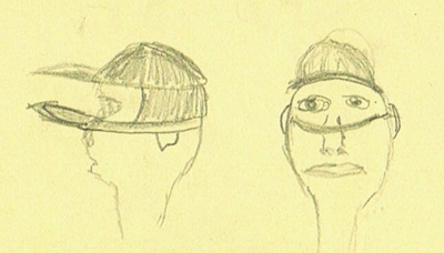 aniridia-visor2 Profile and frontal sketch view of aniridia visor on a persons head