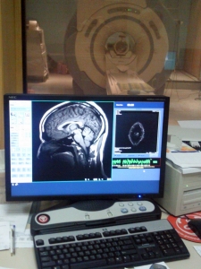Scan of James's head on computer screen with MRI scanner in the background