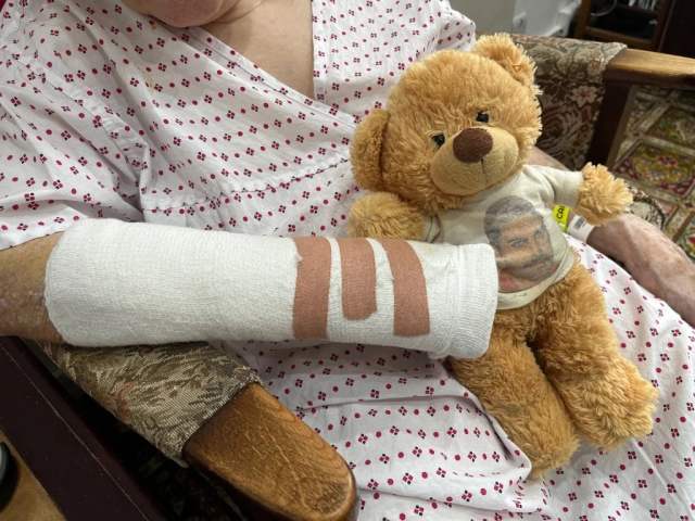A arm in plaster holding a teddy bear on the chest of a woman wearing a hospital gown.